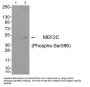 Phospho-MEF2C (Ser396) Antibody