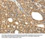 LYZ Antibody