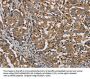 PLIN3 Antibody