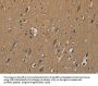 PLIN3 Antibody