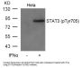 Phospho-STAT3 (Tyr705) Antibody