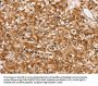 SLC16A8 Antibody