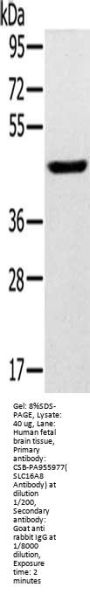SLC16A8 Antibody