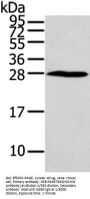 HOXC6 Antibody