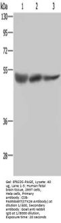 STK26 Antibody