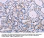 AGT Antibody