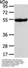 UBAP1 Antibody