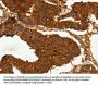 CEACAM21 Antibody
