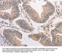 PIP5K1A Antibody