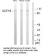 ACTN2/ACTN3 Antibody