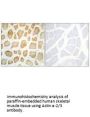 ACTN2/ACTN3 Antibody