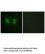 ACTN2/ACTN3 Antibody