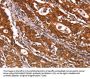 ABI1 Antibody