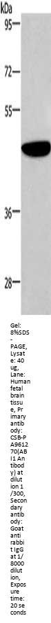 ABI1 Antibody