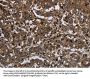 GLIPR1 Antibody