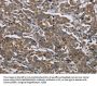 GGCX Antibody
