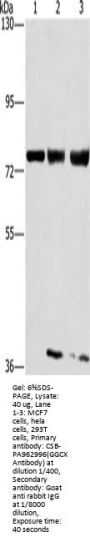 GGCX Antibody