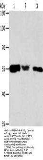 CALR Antibody