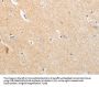 Rabbit anti-human APLNR polyclonal antibody