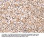 SLC5A11 Antibody