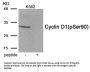 Phospho-CCND1 (Ser90) Antibody