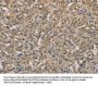 AGTRAP Antibody