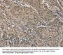 AGTRAP Antibody