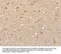 Rabbit anti-human PHLPP1 polyclonal antibody