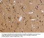 ITPR3 Antibody