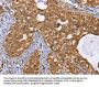 IDH1 Antibody