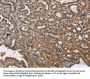 IDH1 Antibody