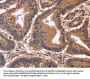 CCDC106 Antibody