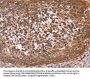 CCDC106 Antibody