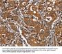 CEACAM3 Antibody
