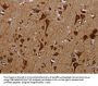 KMT2D Antibody