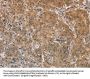 AGTRAP Antibody