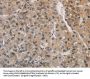 AGTRAP Antibody