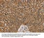 NDEL1 Antibody