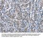 Rabbit anti-human CD226 polyclonal antibody