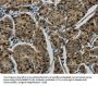 LIG1 Antibody