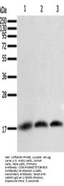 BIRC5 Antibody