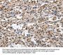 CD163 Antibody