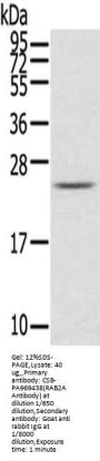 RAB2A Antibody