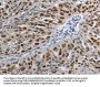 MCM3 Antibody