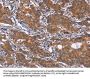 GLS Antibody