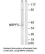 NBPF5P Antibody
