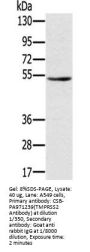 TMPRSS2 Antibody