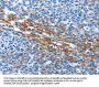 Rabbit anti-human PAK6 polyclonal antibody