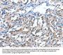 Rabbit anti-human PAK6 polyclonal antibody