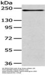 ERBB2 Antibody